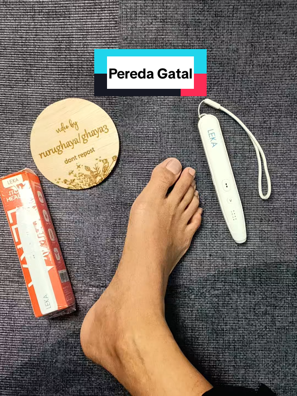 LEKA ITCH HEALER PEREDA GATAL #promoguncang1010 #itchhealer #peredagatal  #modalkontendoang #gajiansale 