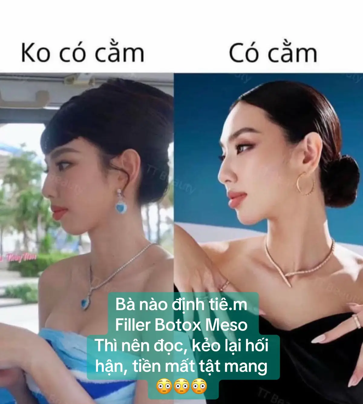 Những điều cần biết khi làm đẹp 👌🏻 #filler #botox #mesotherapy #xuhuong #chamsocda 