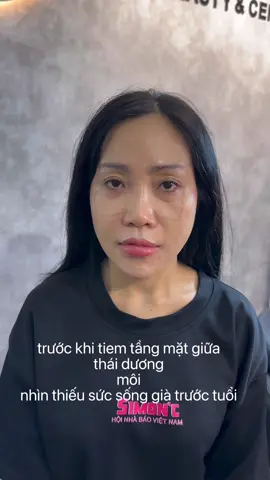 trẻ ra 5 tuổi luôn ạ #xuhuong #tangmatgiua #tiemtangmatgiua #thaiduong #moidep 