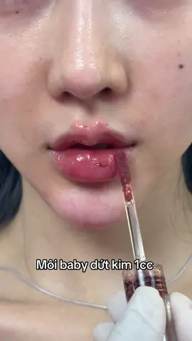 Không còn lời nào diễn tả môi xinh 🥰🥰#nângtầngmặtgiữa #xuhuongtiktok #mdcodes #tiêmmoi #môixinh 