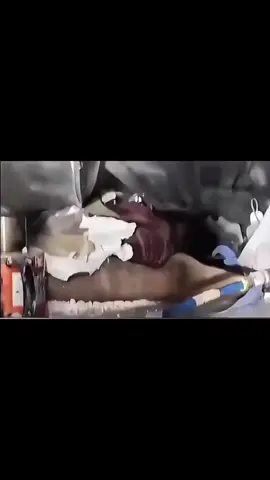 Haikal seorang santri Ponpes Al Khoziny yang terjebak di bawah reruntuhan bangunan selama 3 hari akhirnya berhasil diselamatkan. Dia dievakuasi dalam kondisi selamat dan langsung dilarikan ke rumah sakit untuk mendapatkan perawatan medis, Rabu (1/10/2025). Haikal sempat menjadi perhatian publik setelah rekaman videonya viral di media sosial. Dalam rekaman tersebut, dia masih bisa berkomunikasi dengan petugas SAR meski tubuhnya terhimpit puing bangunan. Ketahanannya bertahan lebih dari 24 jam di bawah reruntuhan menuai pujian banyak pihak.#sidoarjo #pondokpesantren#haikal