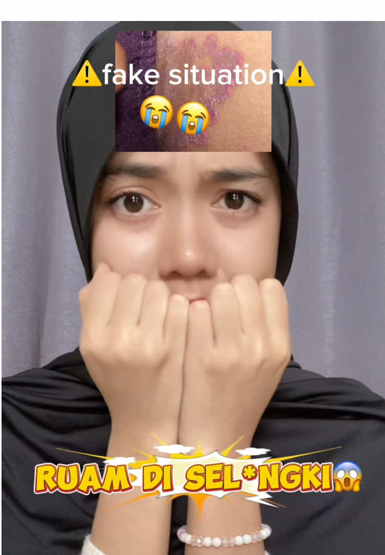 JANGAN BIARIN SEL*NGLI KALIAN TERBENGKALAI🤮 RAWAT SEL*ENGKI KALIAN PAKE PRODUKNYA CIARA YG BESTT BGTT‼️💖😍 #BekasLuka #Ruam #CreamBekasLuka #CreamGatal ##ciaraindonesia 
