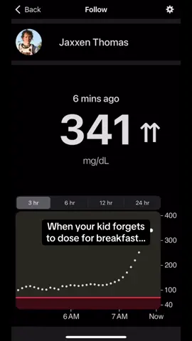 We usually double-check, but this was one of those mornings… he missed the dose, we missed the check. Caught it before it got too bad.  #t1dfamily #bloodsugar #diabetesawareness #t1dlife #dexcom 