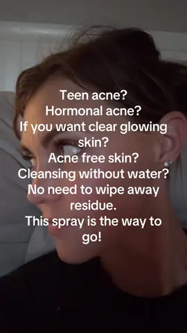 Click the orange shopping cart, it’s the answer to all of the above! #clearskin #acnetreatment #acneproneskin #cleanskin 