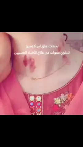 # علامـاتَ الحبَ العشقَ😋😋♥️ .