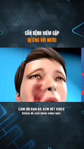 #CapCut anh trưởng đã chở lại #xuhuong #thinhthanh #viral #arsenal 