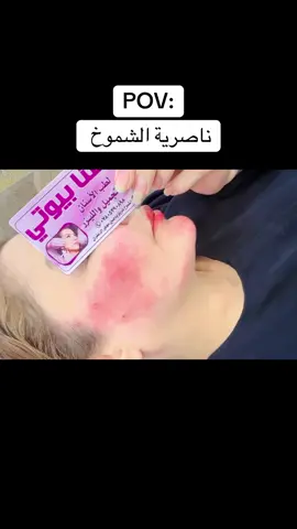 #شعب_الصيني_ماله_حل😂😂 #اكسبور_erolpxe #تكتك_مشاهير #اسنان 