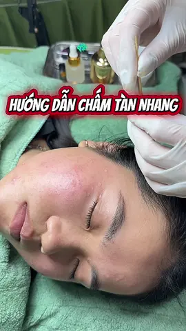 Hướng dẫn chấm Tàn nhang - tinh chất peel da hút sắc tố