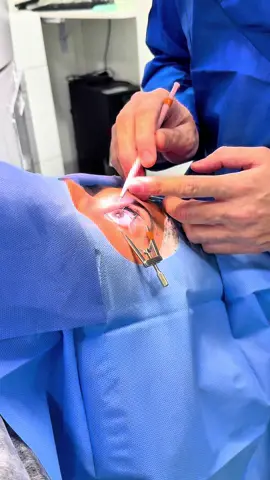 #lasikeyesurgery #lasik #cirurgiarefrativa #cirurgiarefrativaalaser #miopia 