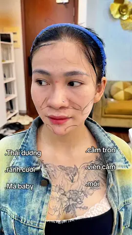 Fullface thay đổi gương mặt gầy😀#làmđẹp #yfp #NguyễnAnh #fillerbottox #fullface 
