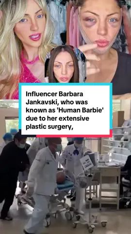 Influencer Barbara Jankavski, who was known as 'Human Barbie' due to her extensive plastic surgery, has died aged 31. The Brazilian social media star, who boasted more than 55,000 followers on Instagram and 344,000 on TikTok, was found dead at a townhouse in Sao Paulo on November 2. Read more at DailyMail. #news #rip #influencer #brazil