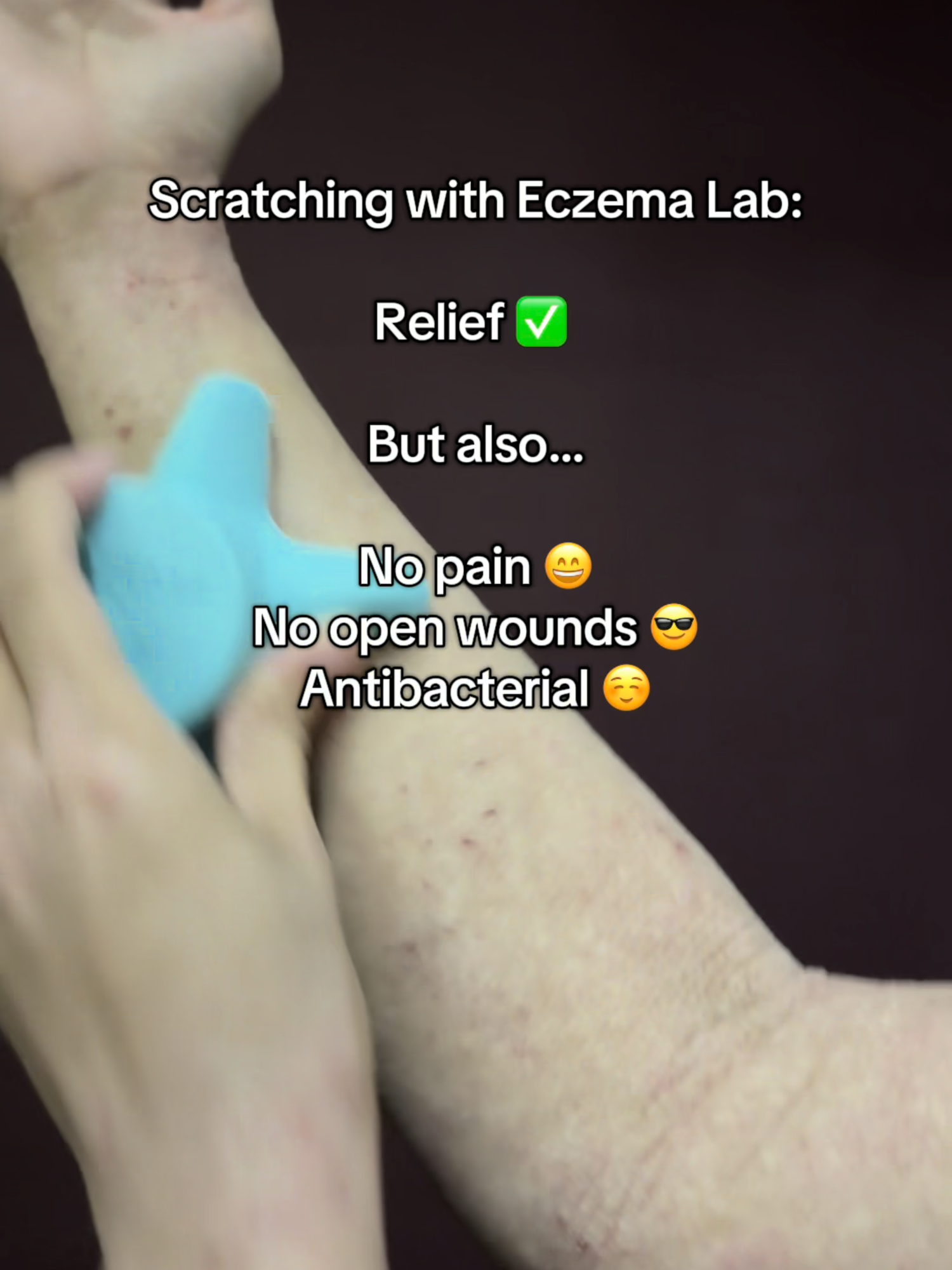 Stop scratching till your skin hurts or bleeds. There’s a safer way. Meet the Eczema Lab Gentle Scratcher — designed to mimic your fingernails so you still get that satisfying scratch, but without damaging your skin barrier. Its proprietary cooling pod gives an instant soothing sensation to calm itch and reduce inflammation. Relief that feels good — without the harm. #eczema #eczemaawareness #eczemacommunity #itch #eczemarelief #eczematok #psoariasis