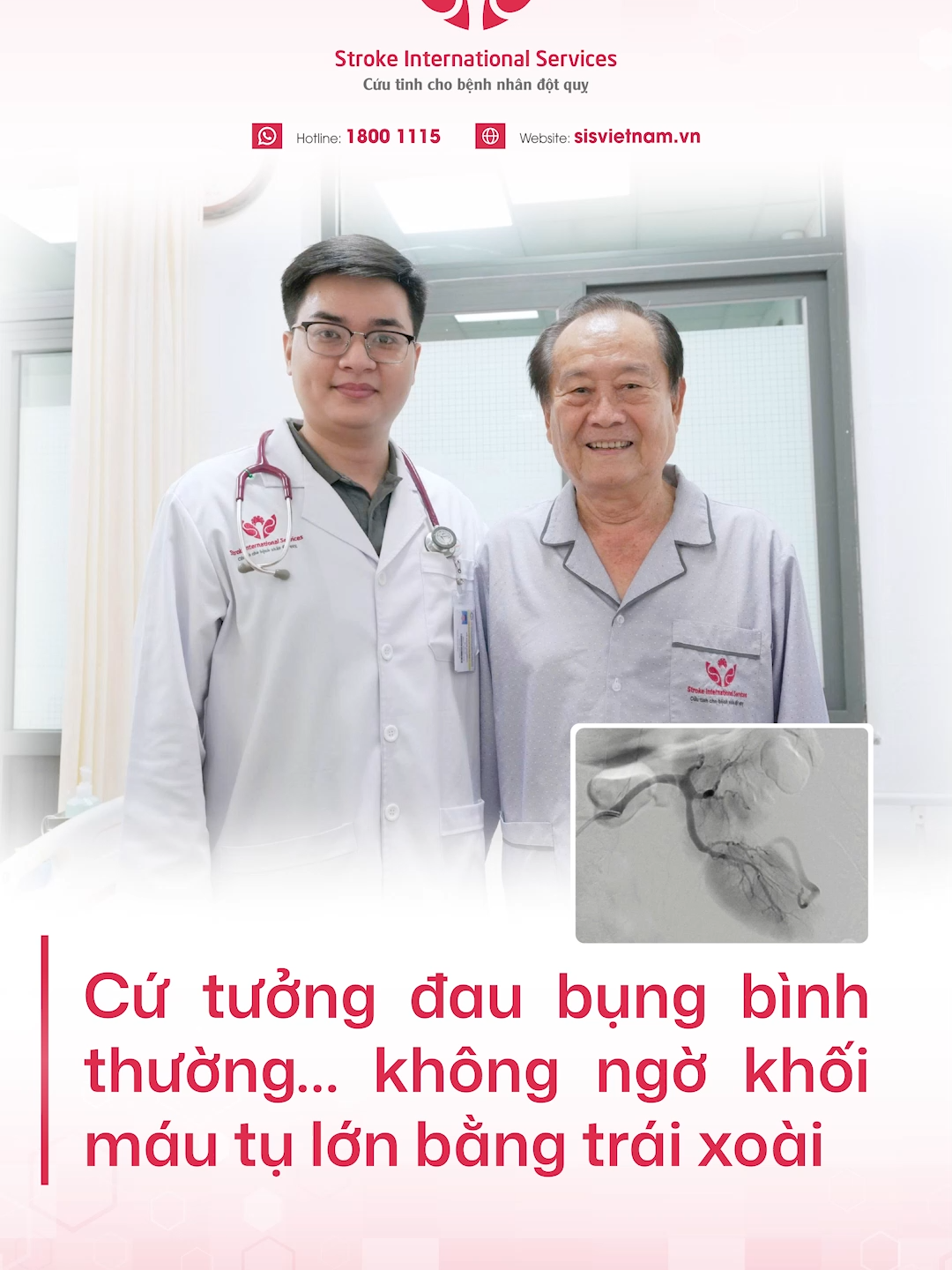 Cứ tưởng đau bụng bình thường… không ngờ khối máu tụ lớn bằng trái xoài#SISVietnam #SISCanTho #sisvisuckhoecongdong #learontiktok #tiktokmentor #suckhoe #songkhoe247 #zalovideo #ctphoton #dotquy #timmach #nhoimaucotim #daithaoduong #tamsoatdotquy #xuongkhop #phongchongdotquy #mcv #taimuihong #zalo #icu