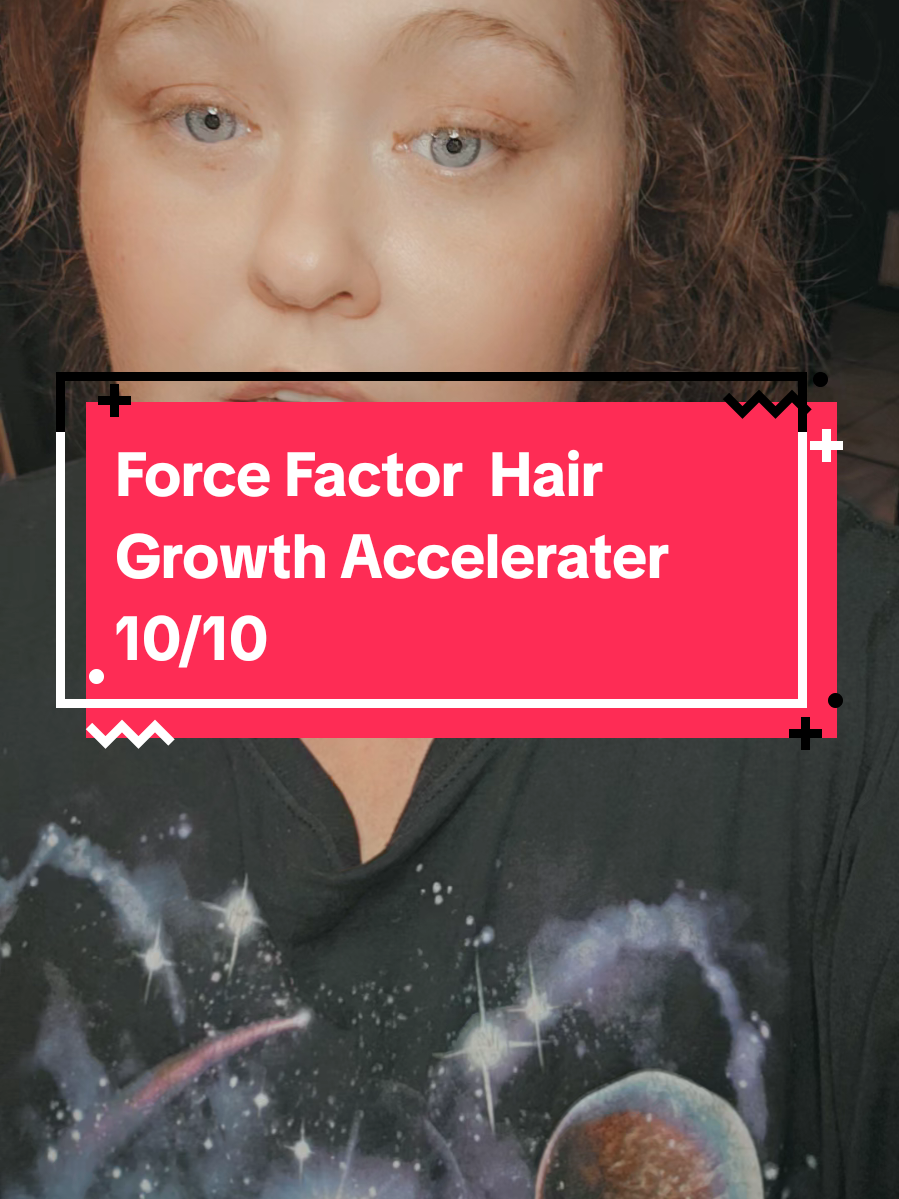 Force Factor Hair Growth Accelerator with Lustriva is the secret you want to know. Lustriva helps and supports hair growth and accelerates growth and results in as little as 3 weeks. Get yours before it sells out again. #forcefactorhairgrowth #forcefactor #hairgrowthtips #lustriva #viralproducts 