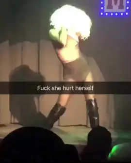 Throwback to when I broke my leg in two places! 