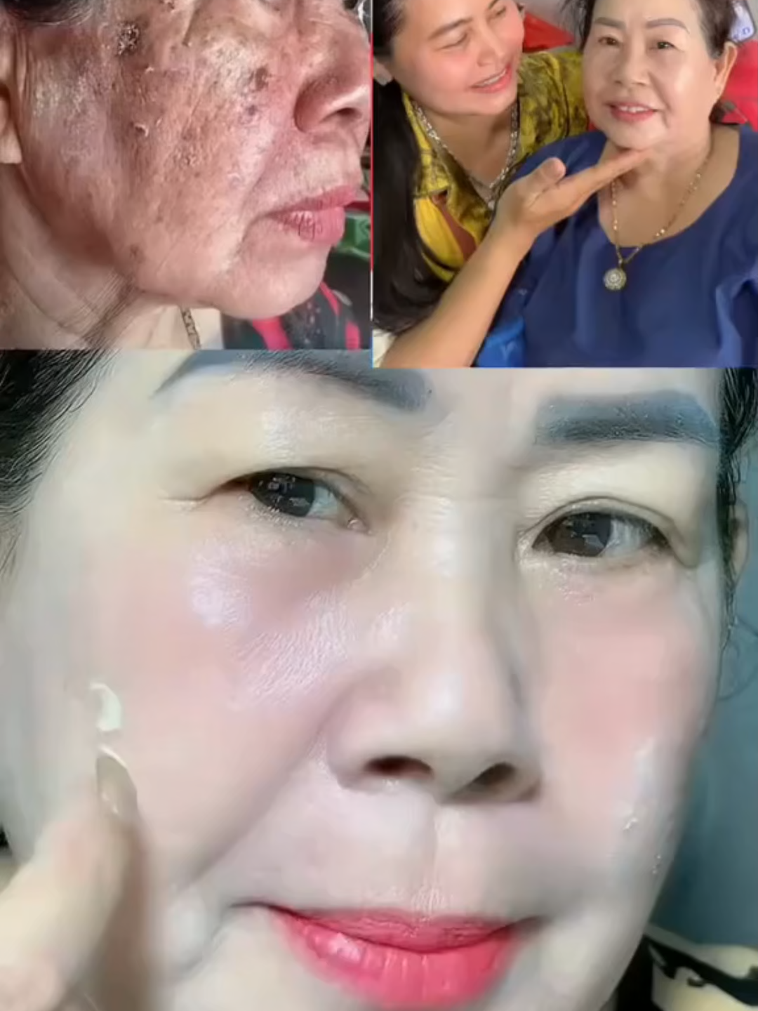 DR DORIGHT tẩy nám trên mặt Chống nhăn - loại bỏ nám sạm - Trẻ ra 10 tuổi chỉ với 1 liệu trình DR