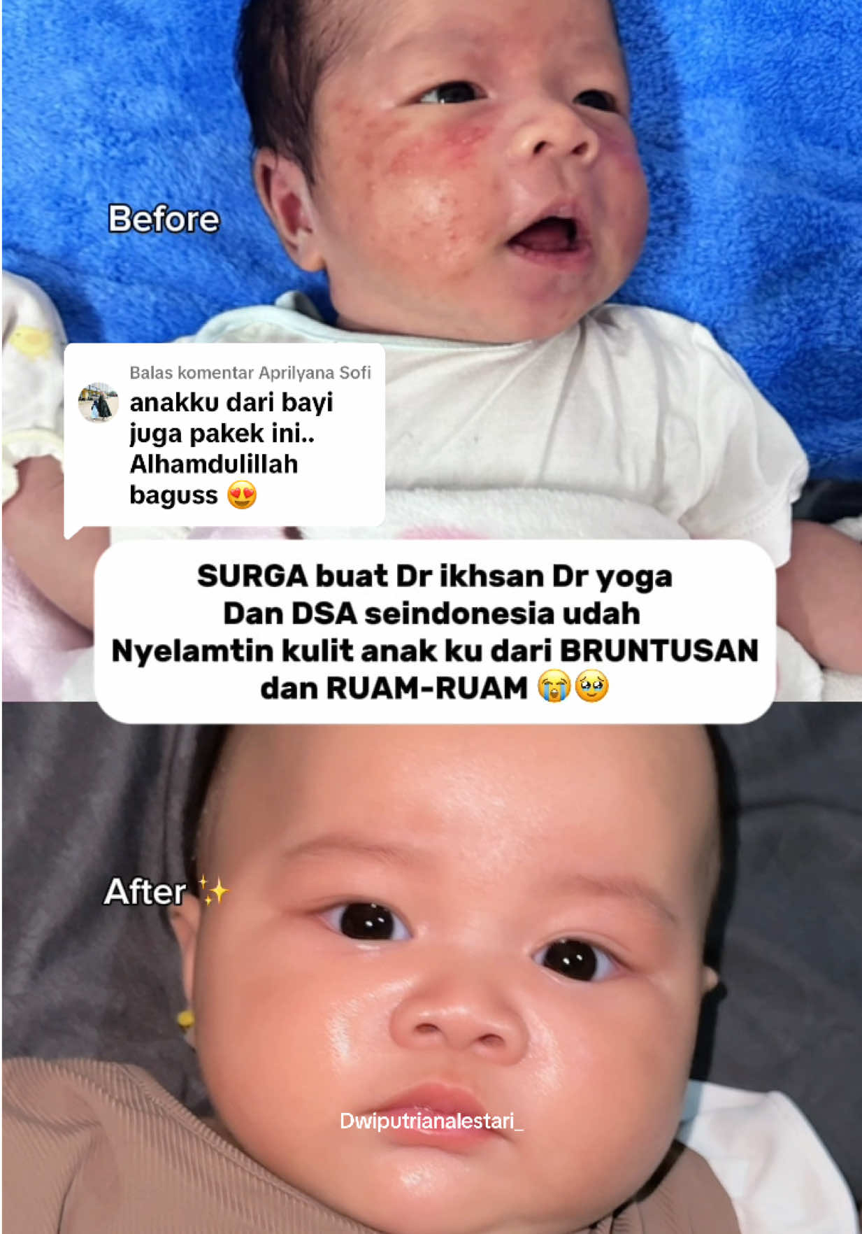 Membalas @Aprilyana Sofi bund wajib pakein dede face cream dari NB jgn maksa pakein bedak tabur 😭 beli ini ya agar gk ruam bruntusan lagi muka nya #facecream #krimwajahbayi #skincarebayi #skincareanak #mamaschoice 