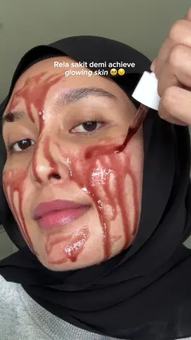 Road to glowing skin with G2G Peeling Solution 👀✨#g2gpeelingsolution #peelingsolutionviral #g2gmy