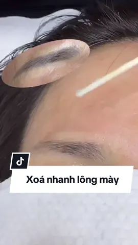 Tháng của xoá lông mày 😁 #phunxamthammy #xoáxămHạLong #xoalongmaylazercaocap 