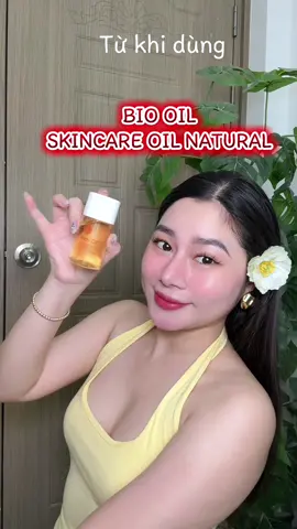 Dưỡng ẩm da gì chưa mấy người đẹp ơi, thử Bio Oil skincare oil natural này đi êm cực. #megawecare #megawecarevietnam #biooilskincareoilnatural 