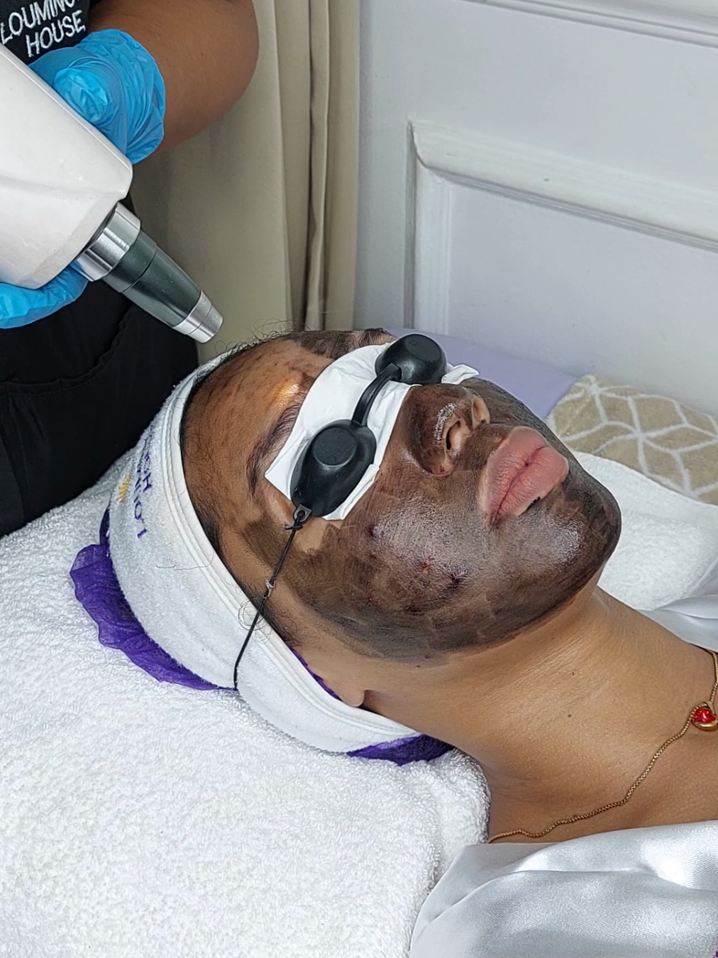 Acne mark problems? Oily skin prone? Book your Carbon black doll laser for only P1,200/ session and get FREE signatured mask. Message us 😊💜✨️ #acnemarks #oilyskin #laser #treatment #fyp 