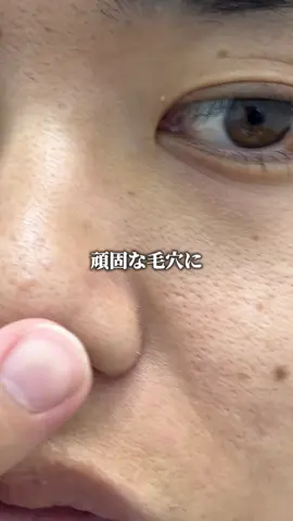 話題の塗るボトックス塗ってみました！ #ボトックス #肌質改善 #スキンケア #美容液 #pr