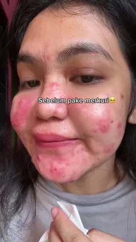 krim kuning kecintaanku ku, tapi ini bukan merkucrit 🔥 #retinolviral #moisturizerviral #retinoid #retinol 