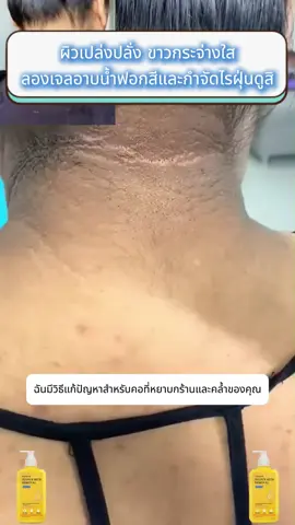 125 ซื้อ 1 แถม 1! ครีมอาบน้ำ Cuishifan สูตรขาวกระจ่างใส โปรโมชั่นสุดฮอต!CJL