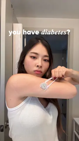Should you tell your employer about your diabetes? #type1diabetes 