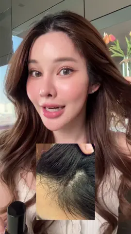ผมขึ้นใหม่จริงๆค่าาา 😱  #ของดีบอกต่อ #รีวิวบิวตี้ #IntensiveHairSerum #nectapharma 