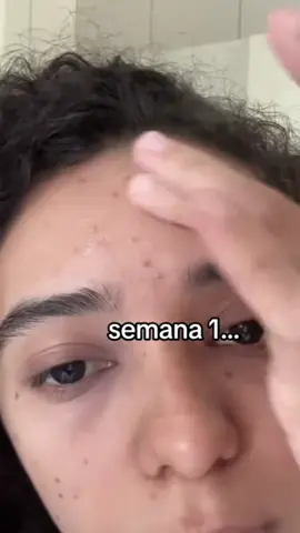 #serum #skincare #face 