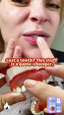 Some people actually build full teeth with this — it hardens really well.