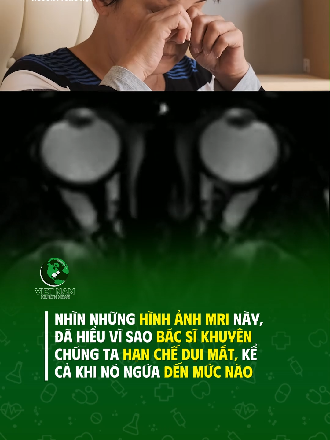 Hạn chế dụi mắt nhé mọi người #vnhealthnews #tiktoknews
