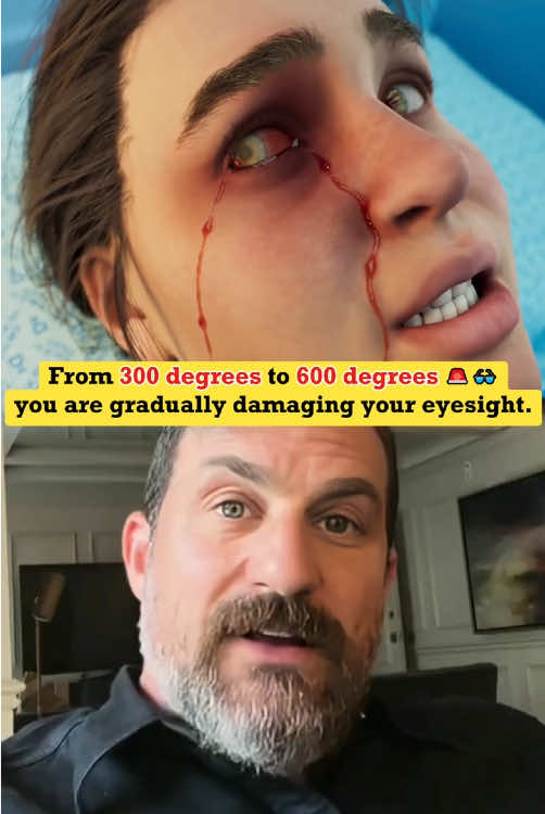 Do you have any vision problems? You might as well listen to his explanation.#tiktok #fyp #healthy #eyes #aihost 