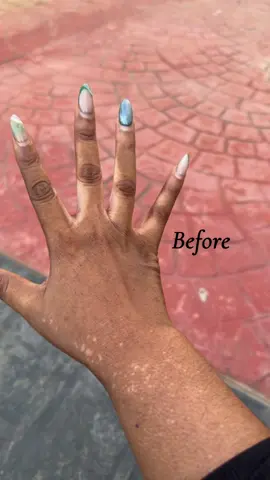 Knuckle cream + Snow White lotion  Our  knuckles Cream works effectively 👌👌👌👌👌👌👌👌 #skincareinibadan  #skincare  #skinaretips 