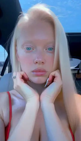 Just me, nothing crazy 😅✨💃” #albina #albino #funvibes #reelslife #goodenergy 