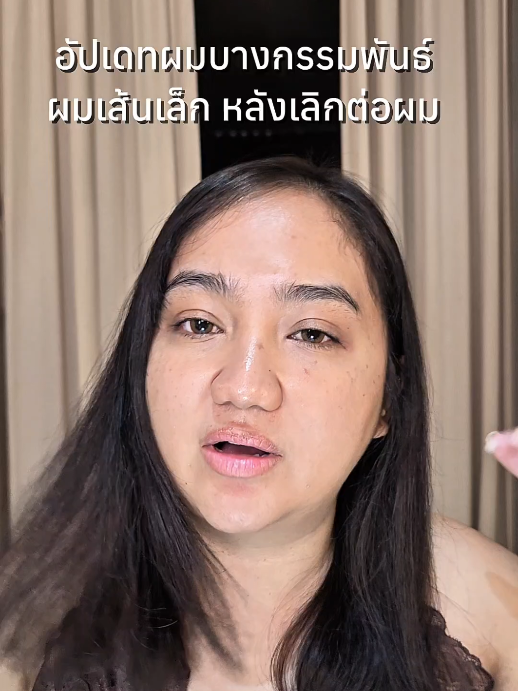 อัปเดทผมบางกรรมพันธ์เส้นเล็กหลังเอาผมต่อออกดูแลยังไง #ผมบาง 