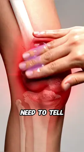 #JointPain #KneePain #BackPain #fyp #NeckPain 