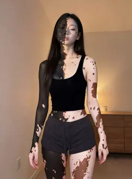 feeling this fit🤫 #fyp #reels #beauty #vitiligo #korean 