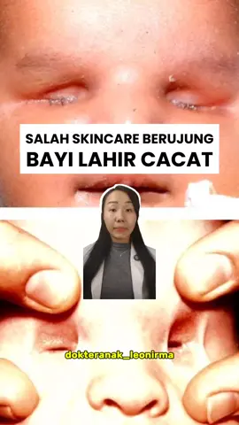 JANGAN SAMPE NYESEL❗ Gak semua skincare aman dipake ibu hamil. Skincare tertentu misalnya Retinol, Hidrokuinon, Salicylic Acid (BHA) dosis tinggi, Oxybenzone, dll bisa ganggu pertumbuhan janin, berisiko bumil ngalamin keguguran atau lahiran prematur, ganggu hormon, dan bahkan kecacatan janin. Inget ya momdads, kulit kita itu bisa nyerep zat kimia ke aliran darah. Selalu cek label komposisi skincare sebelum dipake, cek BPOM buat liat keamanan produk, dan konsul ke dokter buat lebih jelas Yuk lebih selektif sebelum konsumsi apapun. Jangan sampe niat glowing kita malah bikin bayi menderita 💔 #skincarebumil #bayisehat #fyp #fyppppppppppppppppppppppp  #creatorsearchinsights  Credit: siskasiska9349