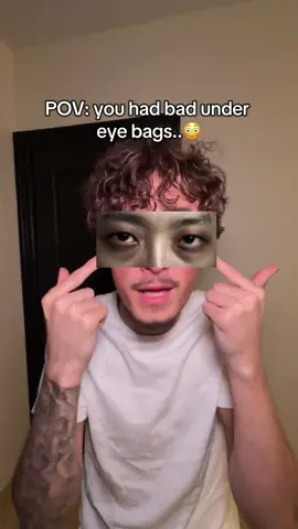 Best way to fix under eye bags