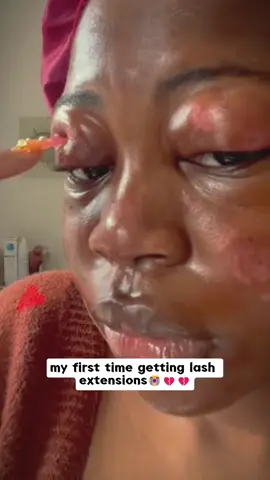 😭💔💔#ashtech#salon#woman#hospital #eyelashes
