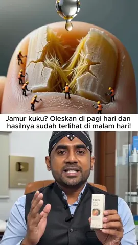 😠Perbaikan dalam 7 hari; ini adalah cara ampuh untuk menghilangkan jamur sepenuhnya.