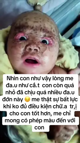 Me tin sẽ có những tấm lòng hảo tâm yêu thương và che trở cho con, me thật sự bât lực khi ko làm dc những điều tôt đẹp hơn vơi con được, cô chú hoan hỉ ngang qua xin giúp me con em có thêm hy vọng được đên viện điều trị ạ 🙏🙏 #capcut #viral #hoancanhkhokhan #chiaseyeuthuong 