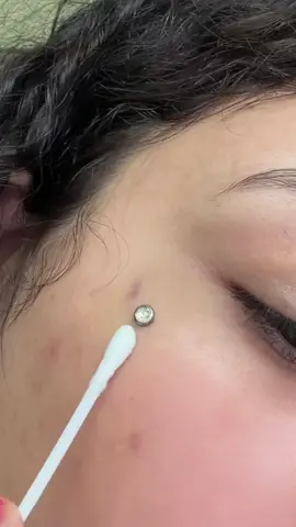 Cleaning my new dermal piercing. I do plan on getting a smaller one in gold color after my 8 weeks of healing Is done. 🙂#fyp #xyzbca #dermal #dermalpiercingvideos #dermalpiercing 