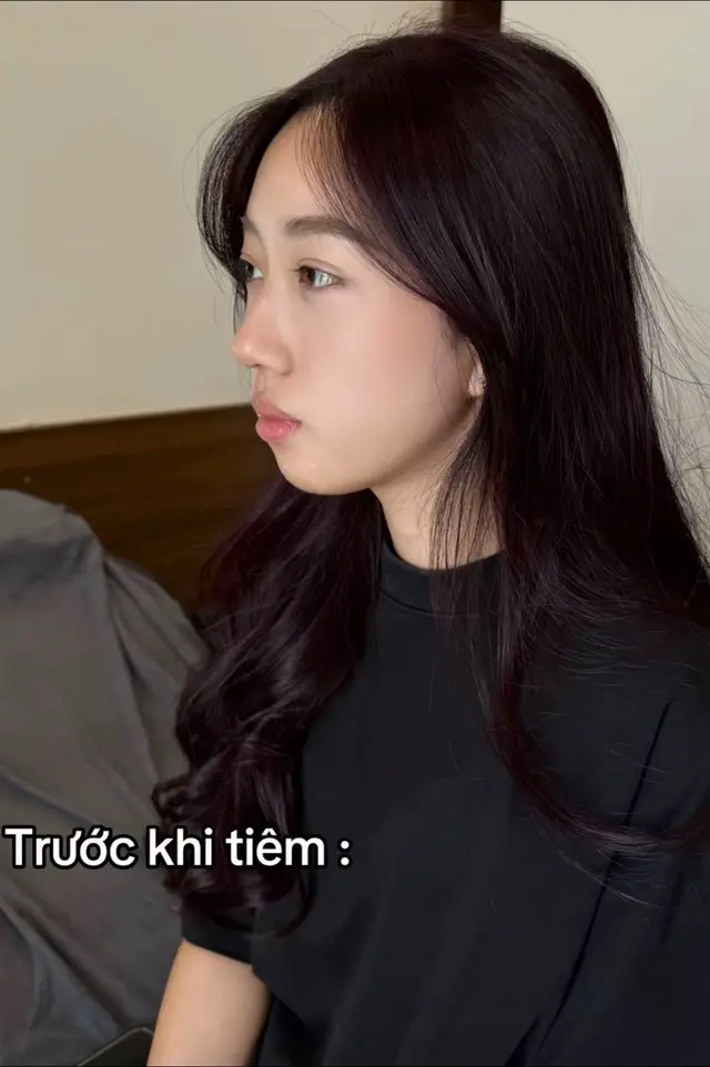 Ti..em cằm 👉 khắc phục tình trạng hô