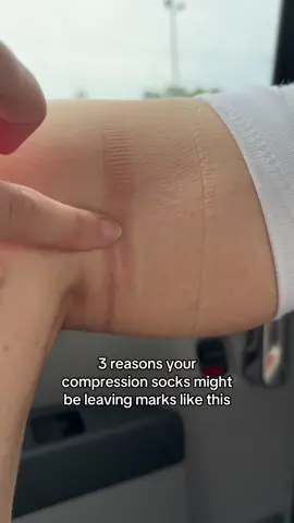 I used to think marks like this from my compression socks were normal. That is until I finally got a pair of compression socks that actually fit.  If your compression socks are leaving marks like this or cutting off circulation behind your knees it likely means: They are not the right size They are too tight by design They are not true graduated compression (tightest at ankle, looser at the cuff) It’s worth noting that of course compression socks are meant to be tight and will absolutely leave some marks on your skin. But they should never be painful or feel like they are cutting off circulation.  A pair of well fitting compression socks will be designed with natural curves in mind, looser at the cuff and a little wider at the calf. They should feel like a gentle hug, not an uncomfortable squeeze. 