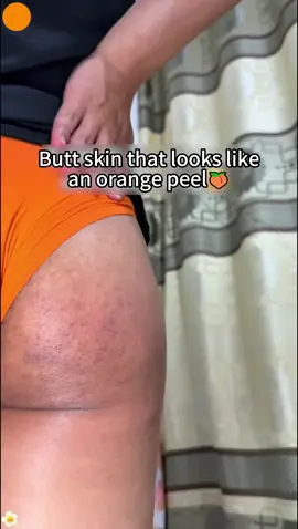 #fyp #fypシ #fyppppppppppppppppppppppp #Keratosispilaris #quarxery #Moisturizing #mites #bodycare #CapCut #acne #clean #foryoupage #foryourepage #bacne #skin #mite #Love #foryou #body #bodywash