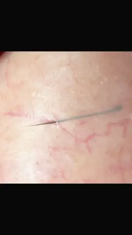 #tweezers #毛抜き 