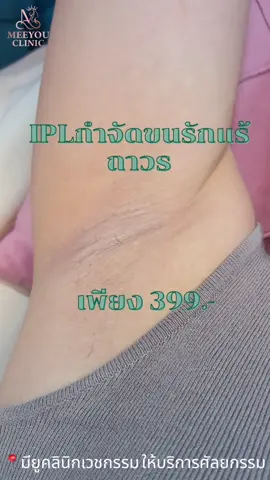 ✨ รักแร้เนียนใส มั่นใจทุกลุคด้วย IPL 🔥 โปรเด็ด! เลเซอร์รักแร้เพียง 399.- เท่านั้น  📌 เหมาะกับคนที่มีปัญหา 💚 ขนรักแร้ขึ้นไว 💚 ลดปัญหาหนังไก่  💚 ผิวคล้ำ ไม่เรียบเนียนช่วยลดขน ลดความหมองคล้ำ 📌 โปรจำนวนจำกัด รีบจองก่อนเต็ม! 📩 ทักแชท / โทรจองคิวได้เลย ☎️084-6992301 📍มียูคลินิก  หน้า รพ.ศรีระยอง #ระยอง #เลเซอร์รักแร้ #meeyouclinic #คลินิกความงามระยอง #ศัลยกรรมระยอง 